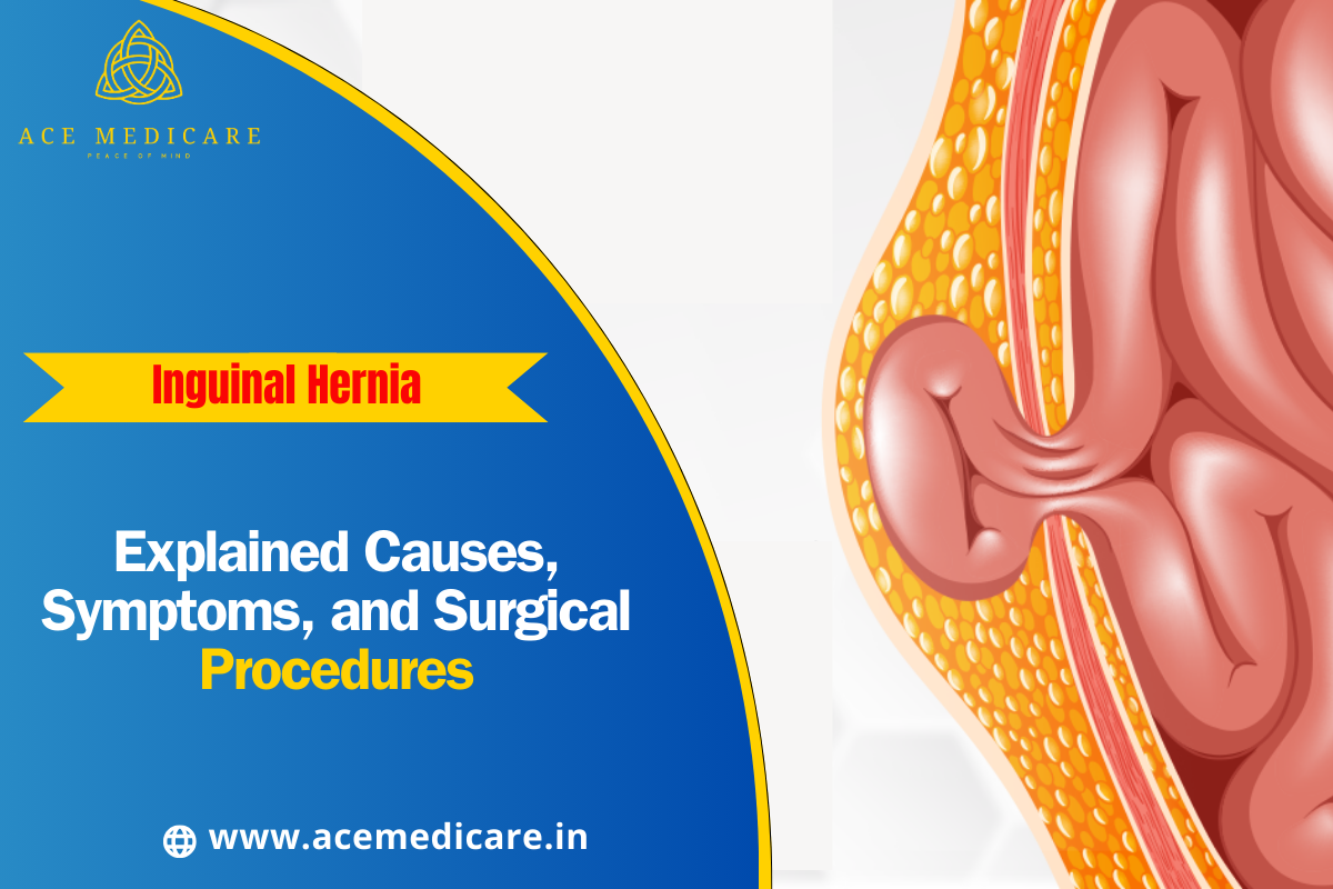 Inguinal Hernia Explained: Causes, Symptoms, and Surgical Procedures